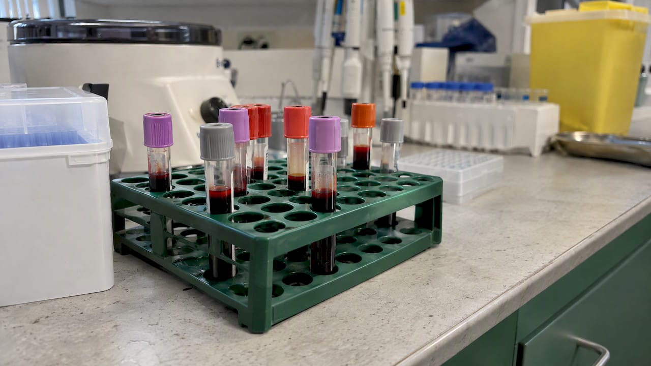 NAD Supplement Bioavailability: What the Human Data Shows